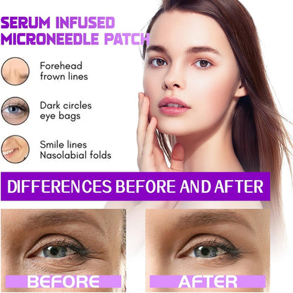 MicroGlow Patches by NOVA LIFT